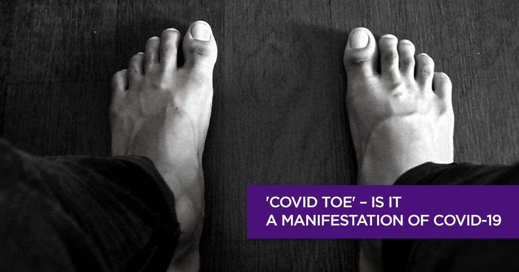 &#8216;COVID Toe&#8217; – is it a manifestation of COVID-19?