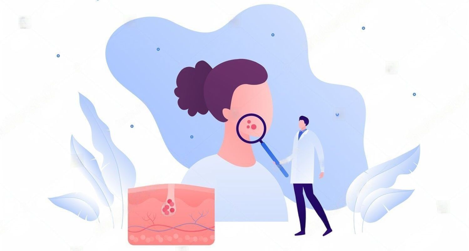 Dermatology – Types of skin diseases, causes, symptoms and Treatments