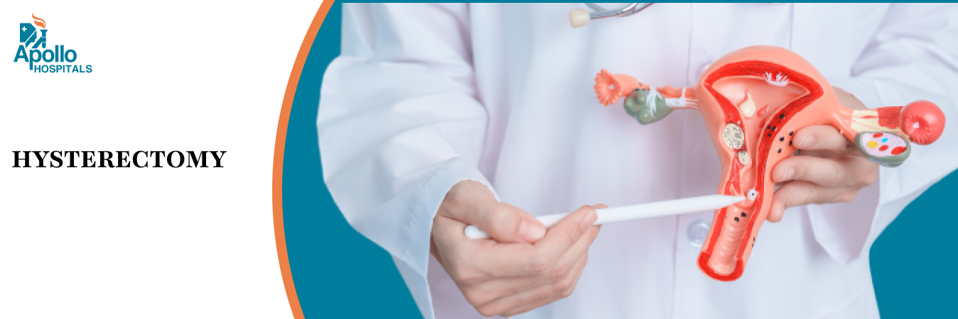 Hysterectomy Surgery