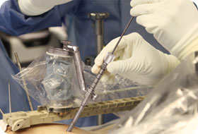 apollo-RBT_Device_and_Guiding_Cannula